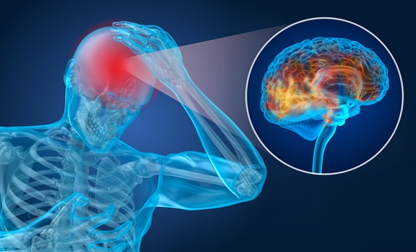 Digital illustration of a skeletal figure holding their head in pain, with a close-up of the brain showing inflammation or injury, representing a concussion or traumatic brain injury.